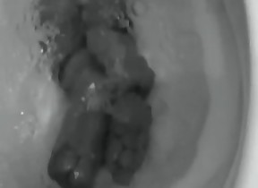 boy poops